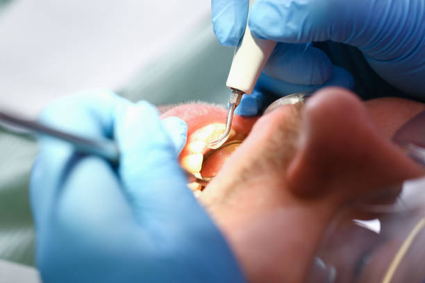 Best Emergency Dental Care for Sports Injuries in Logan, IA